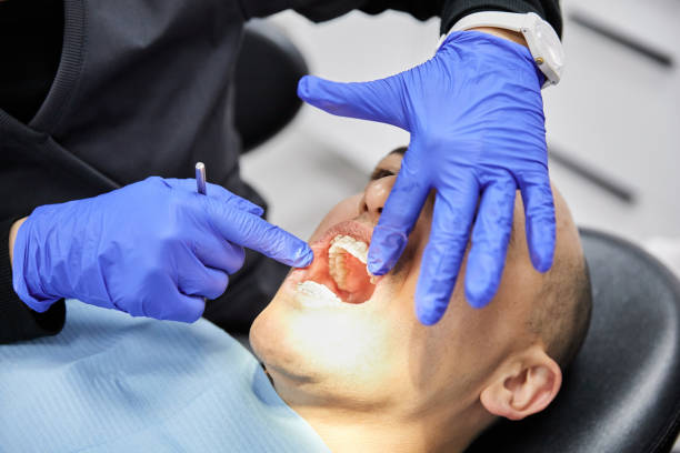Best Dental Abscess Treatment in Summitville, IN